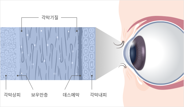 아이러브안과 - EYELOVE EYE CLINIC