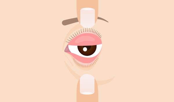 아이러브안과 - EYELOVE EYE CLINIC