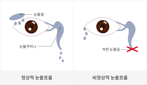 아이러브안과 - EYELOVE EYE CLINIC